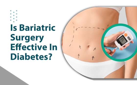 Is Bariatric Surgery effective in Diabetes?
