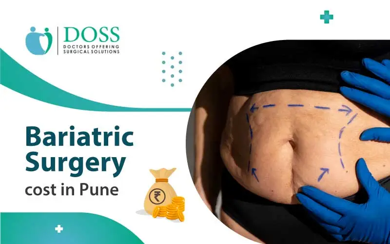 Bariatric Surgery Cost In Pune