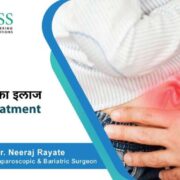 Treatment Options for Hernia