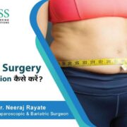 How to Prepare for Bariatric Surgery