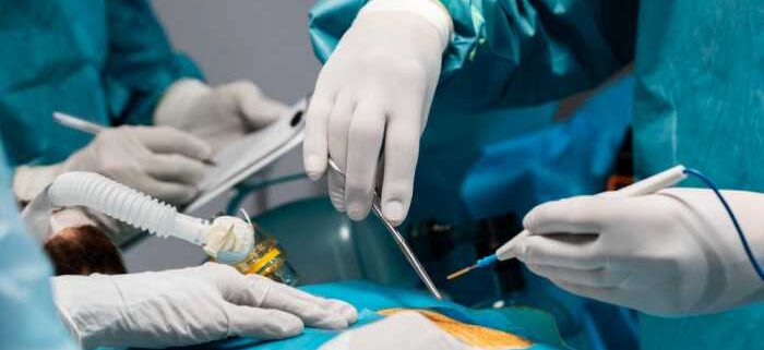 Recovery Tips for Laparoscopic Surgery
