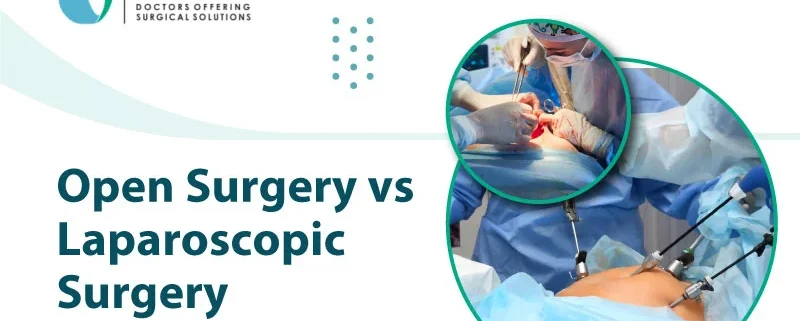 Open Surgery vs Laparoscopic Surgery
