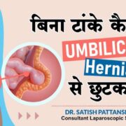 Umbilical Hernia Treatment