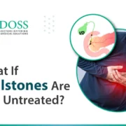 What if Gallstones are Left Untreated