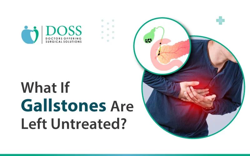 What if Gallstones are Left Untreated