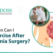 When Can I Exercise After Hernia Surgery