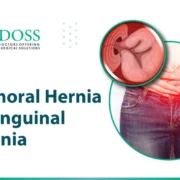 Femoral-Hernia-vs-Inguinal-Hernia
