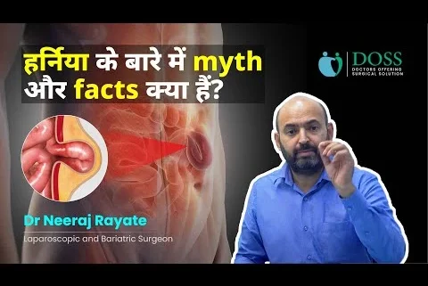 hernia-Myth and Facts