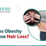 does obesity cause hair loss?