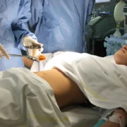 WHEN IS GALLBLADDER SURGERY NEEDED?