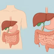 Digestive Changes After Gallbladder Removal