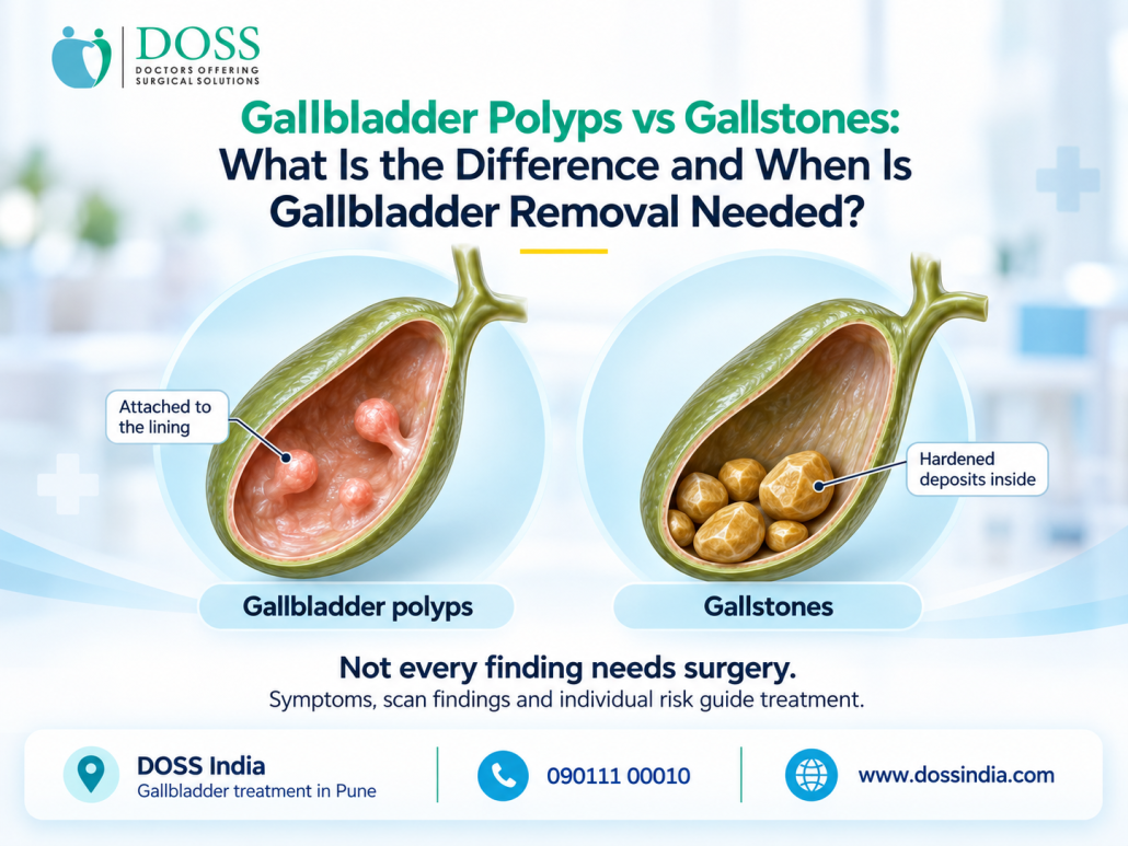 Gallbladder Treatment in Pune