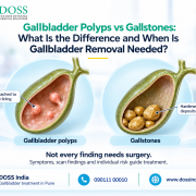 Gallbladder Treatment in Pune